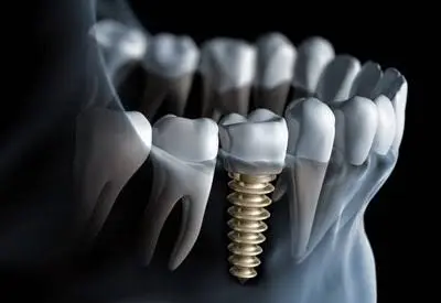Green Dental Care