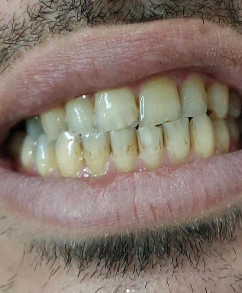 Dena Dental