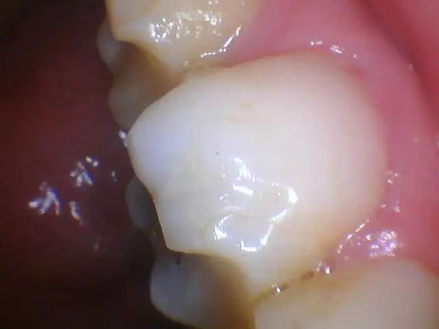 Smile Dentistry at Herons Hill