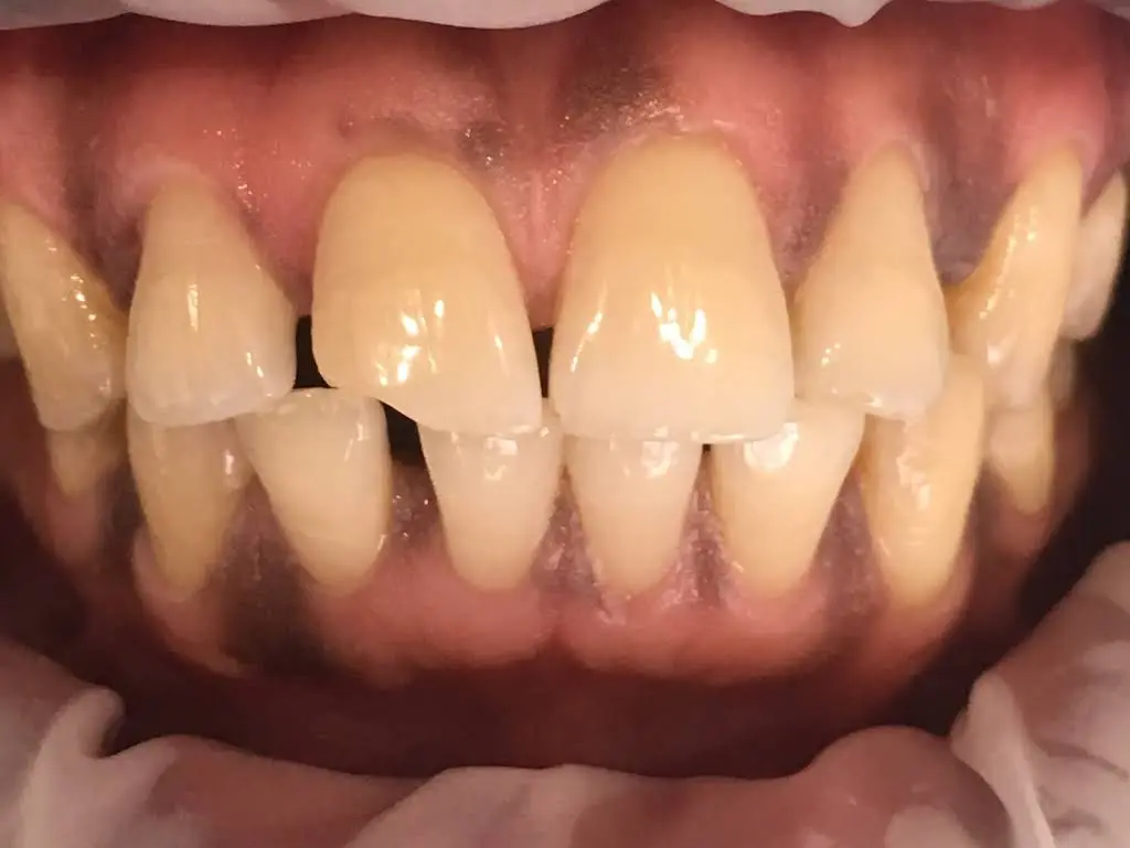 Toronto Family Dental - Dr. Ted Liu