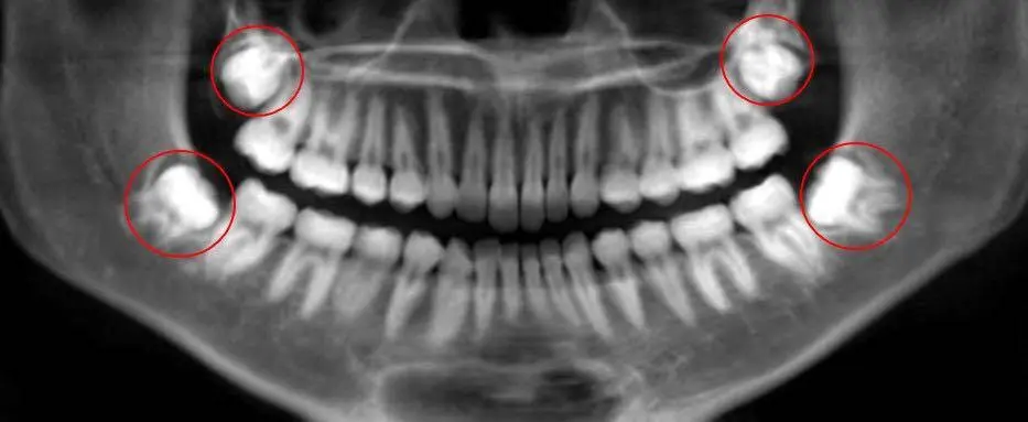 Oral and Facial Surgery Associates, LLC