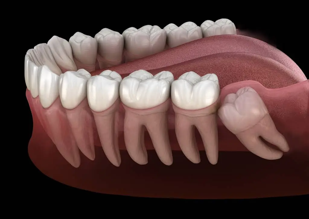 Southern Indiana Oral Surgery