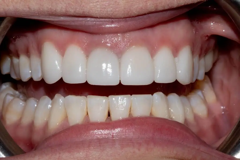 English Dental