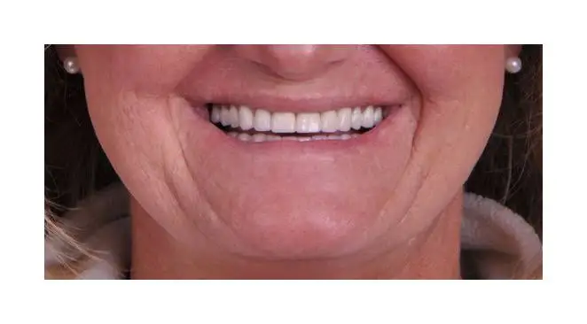 Charette Prosthodontics and Implant Dentistry