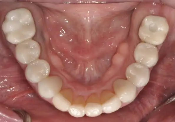 Charette Prosthodontics and Implant Dentistry