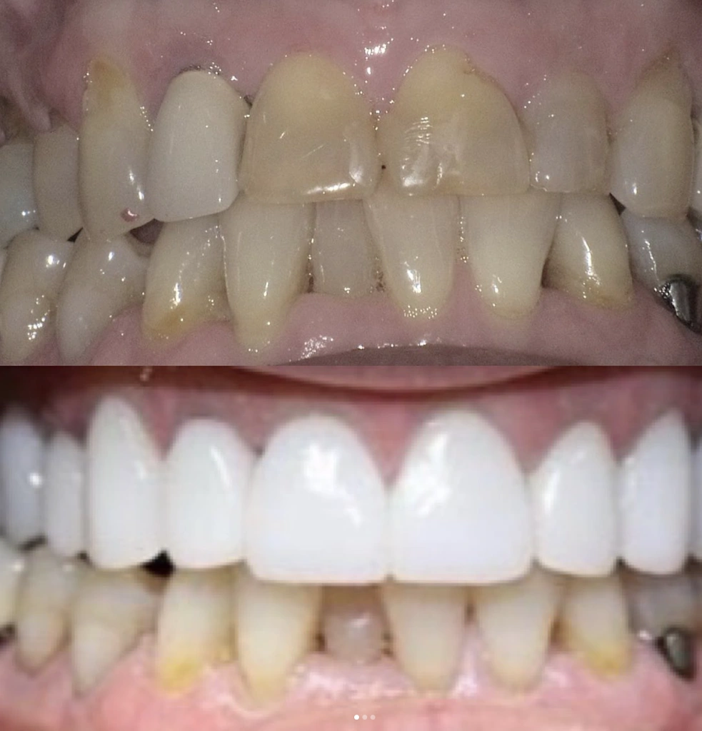 Milford Dental Excellence
