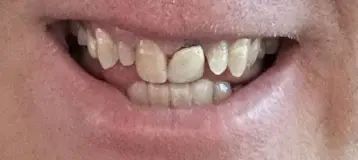 Village Dental of Milford