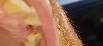 Watson Dental LLC