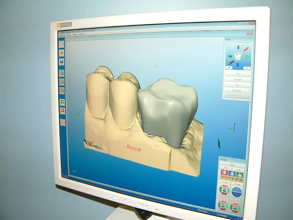Avery Dental Group