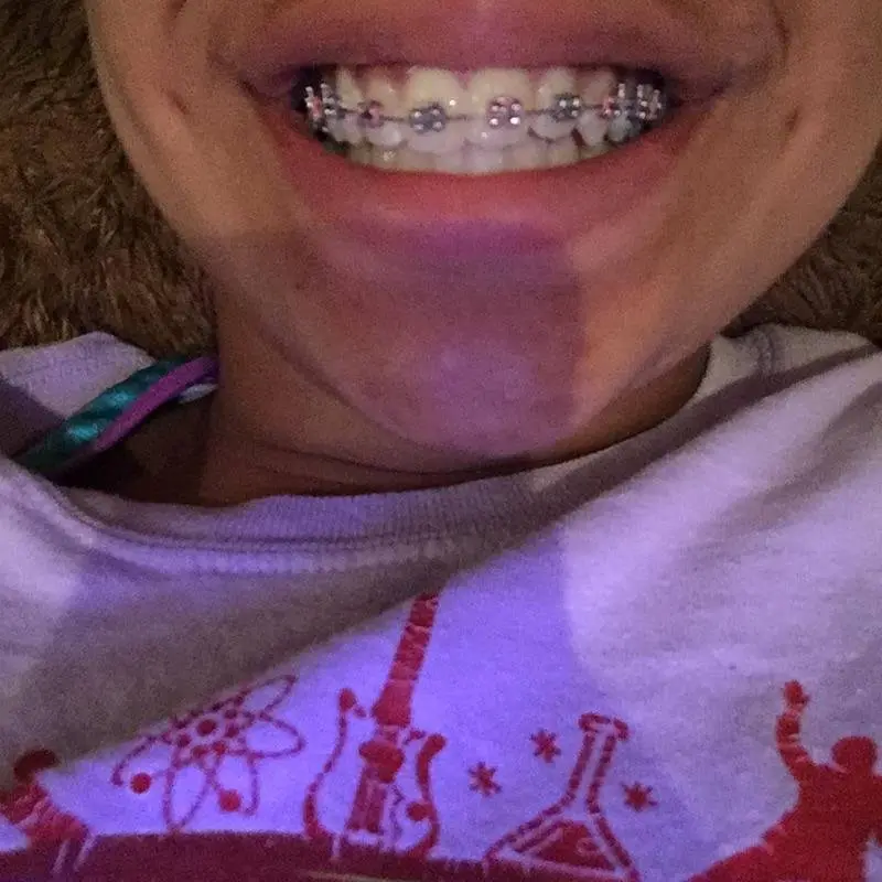 Hudec Dental