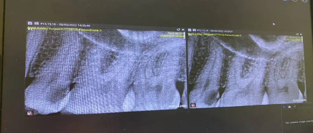 Aspen Dental