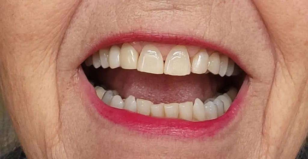 Summit Dentistry