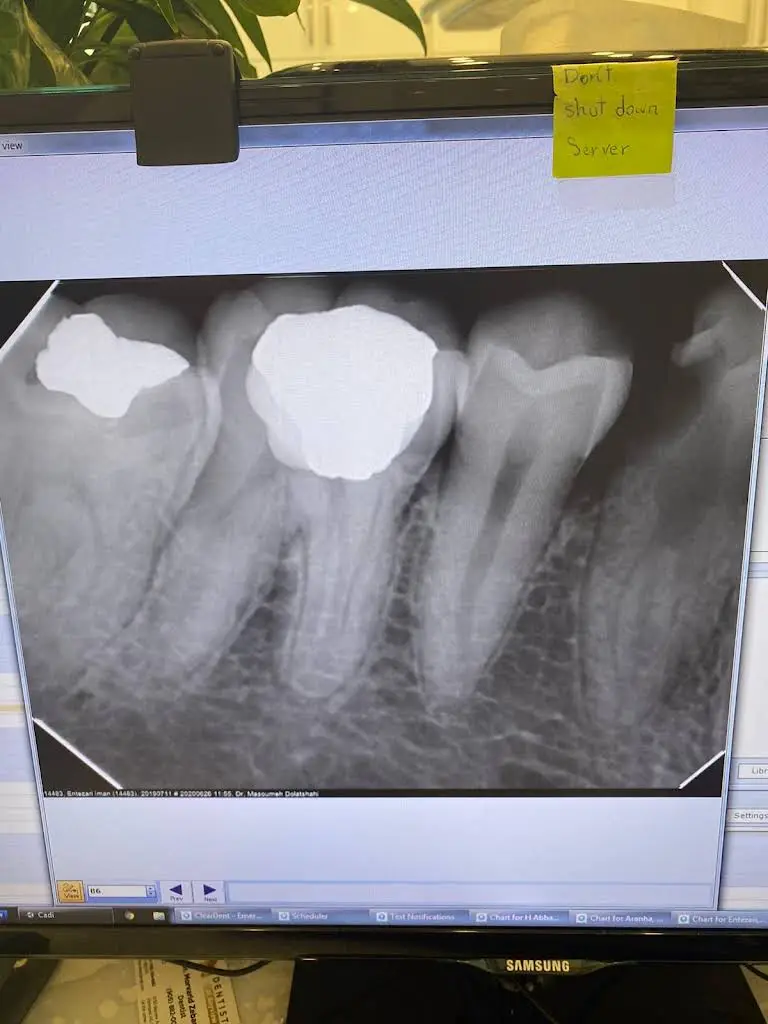 SmileCare Dental Markham
