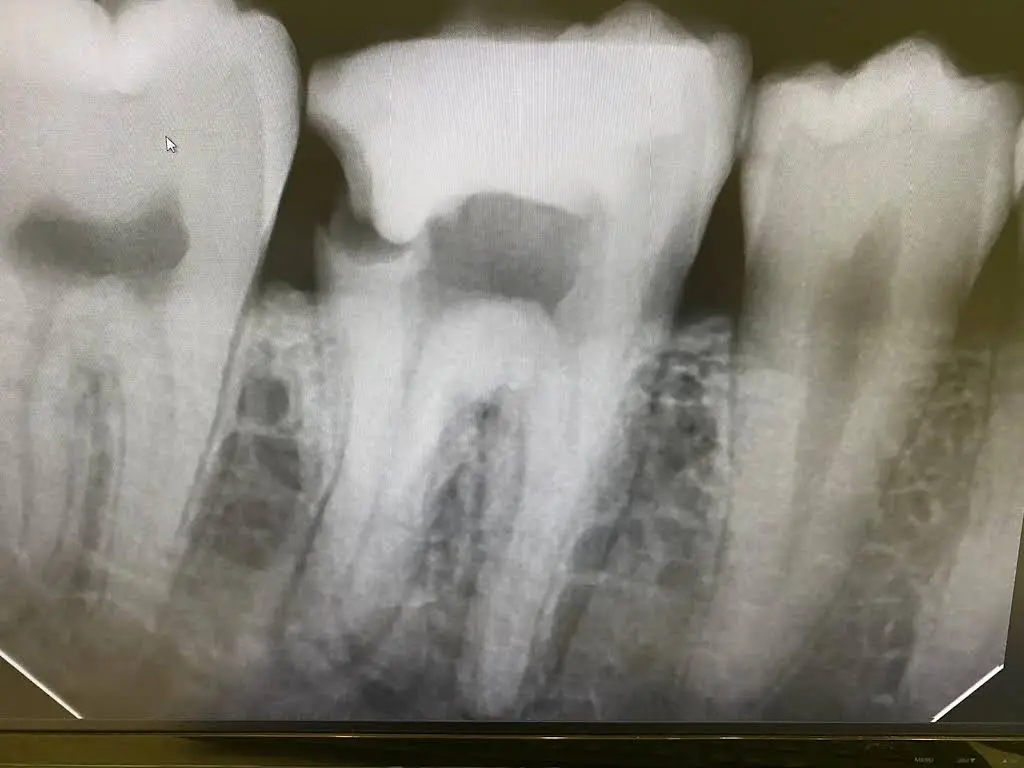 SmileCare Dental Markham