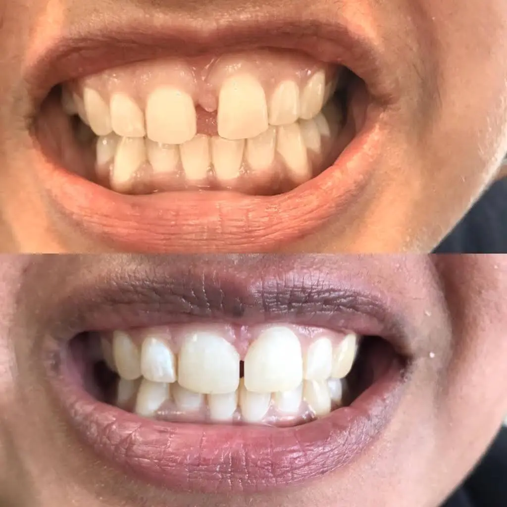 SmileCare Dental Markham