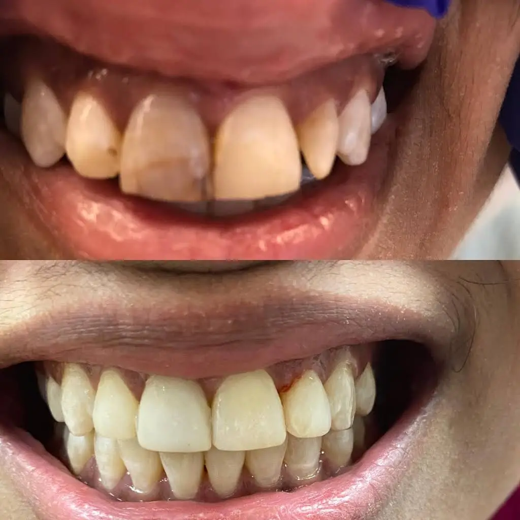 SmileCare Dental Markham