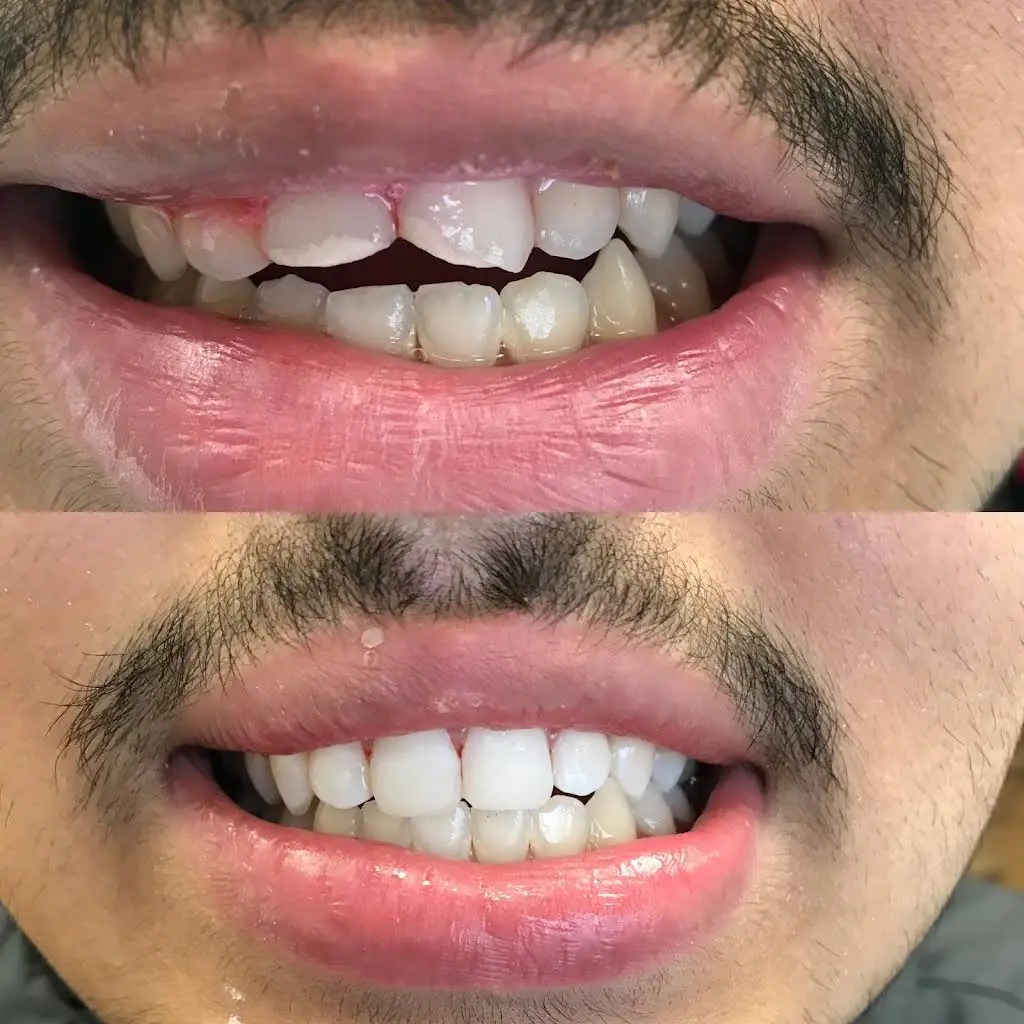 SmileCare Dental Markham