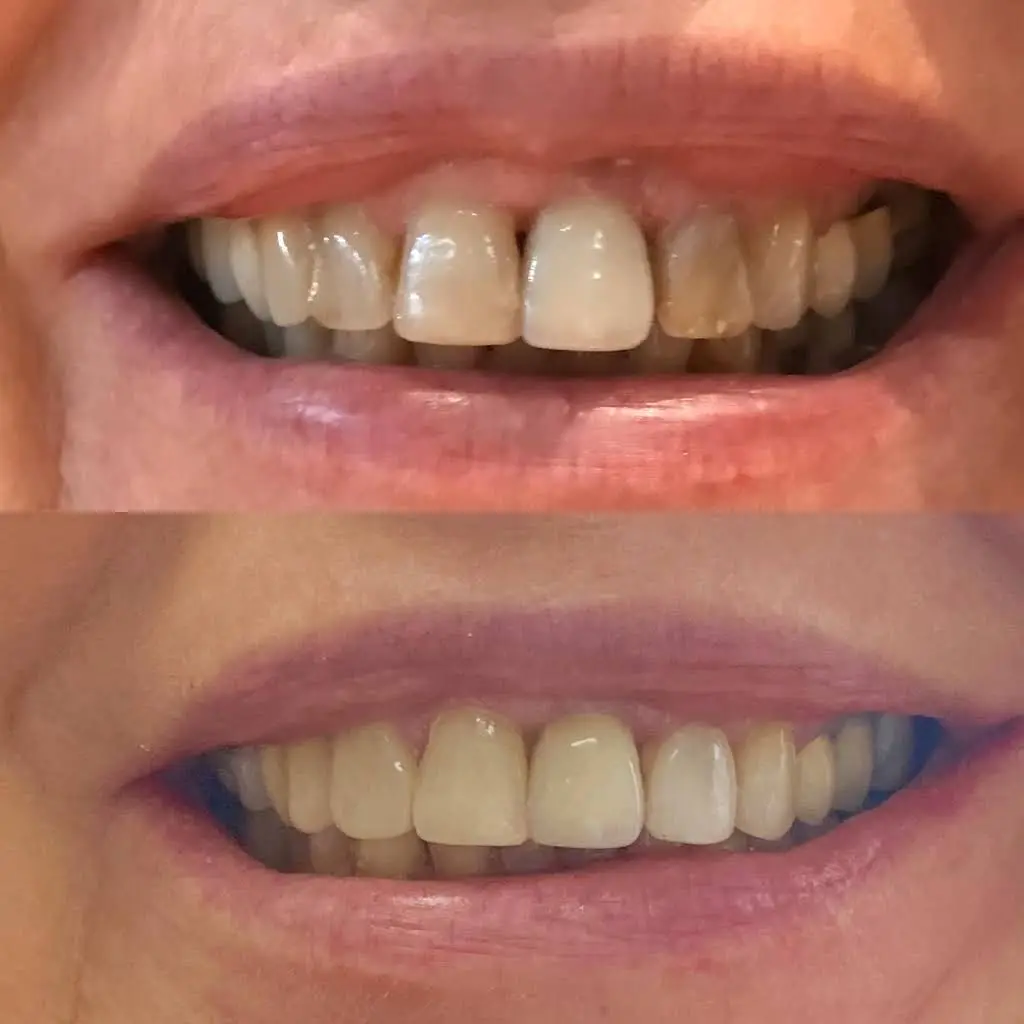 SmileCare Dental Markham