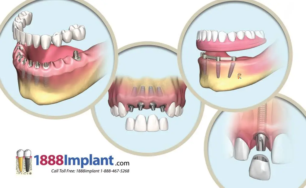 Bloor Jane Dental Health Center