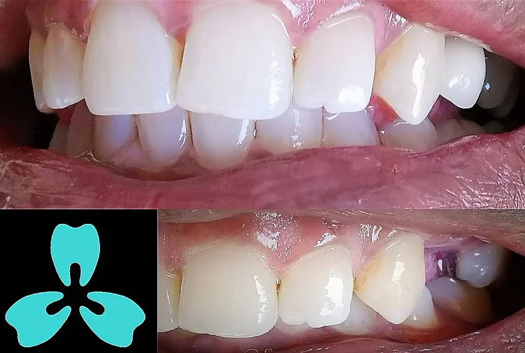 PleasantView Family Dental