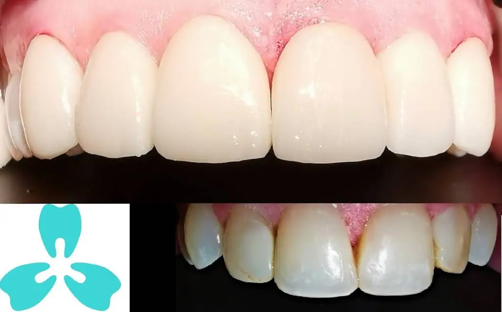 PleasantView Family Dental