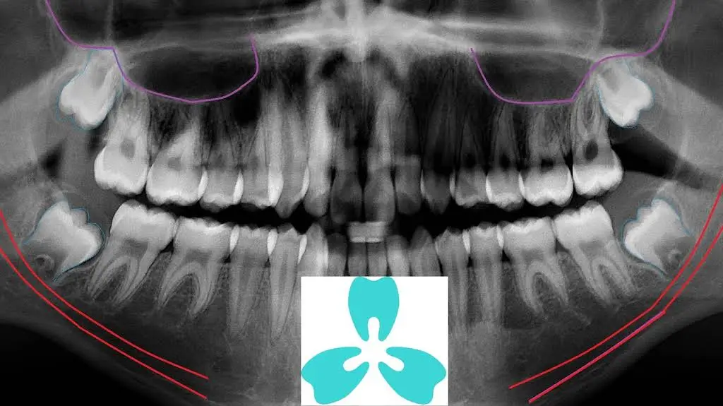 PleasantView Family Dental