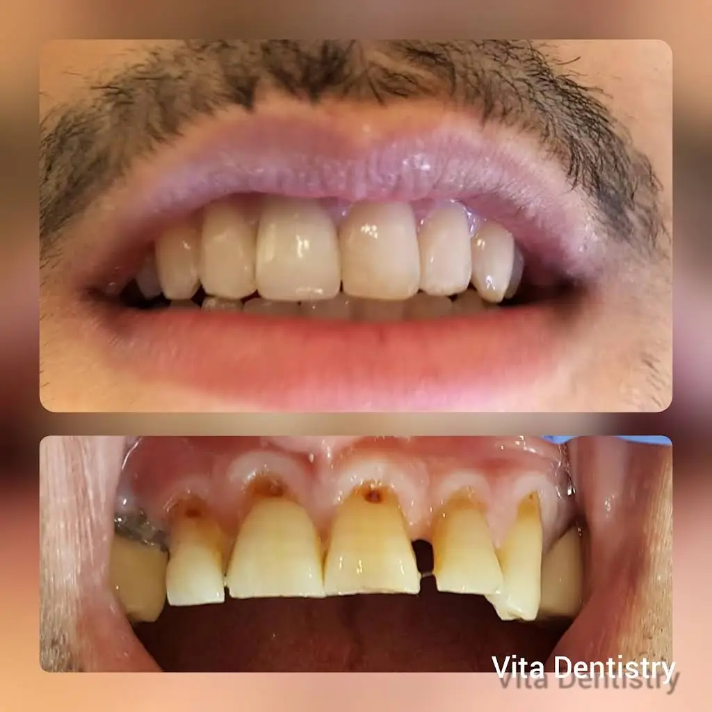 Vita Dentistry