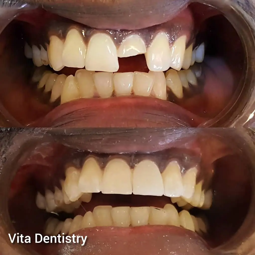 Vita Dentistry