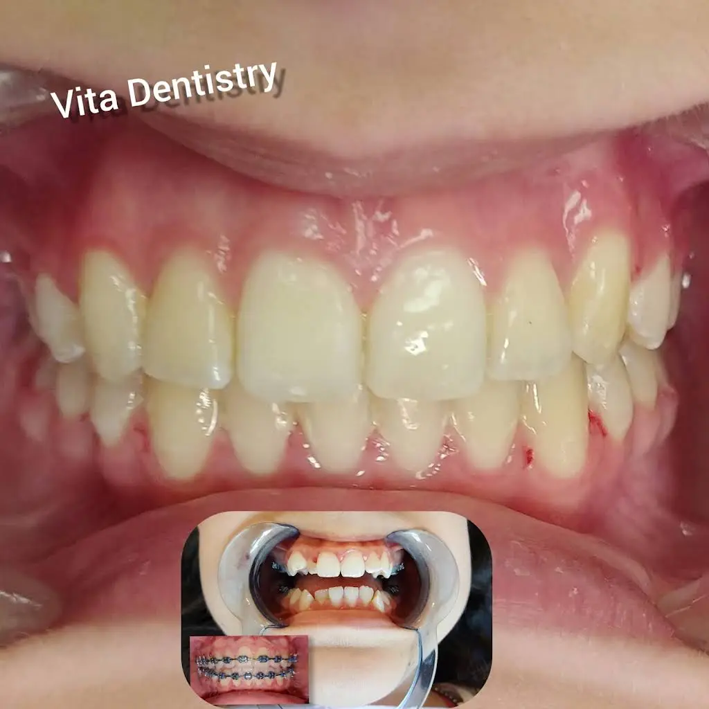 Vita Dentistry