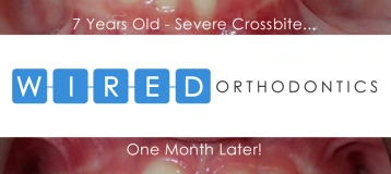 Wired Orthodontics