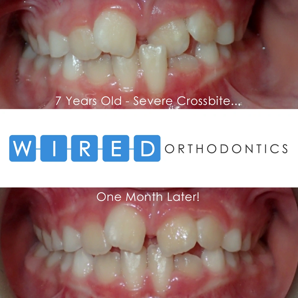 Wired Orthodontics