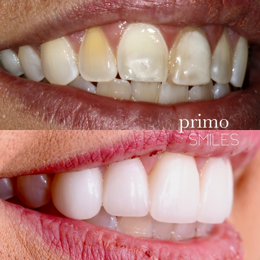Primo Smiles - Christopher Kerns DMD