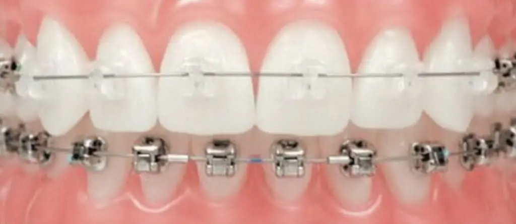 Henn Orthodontics