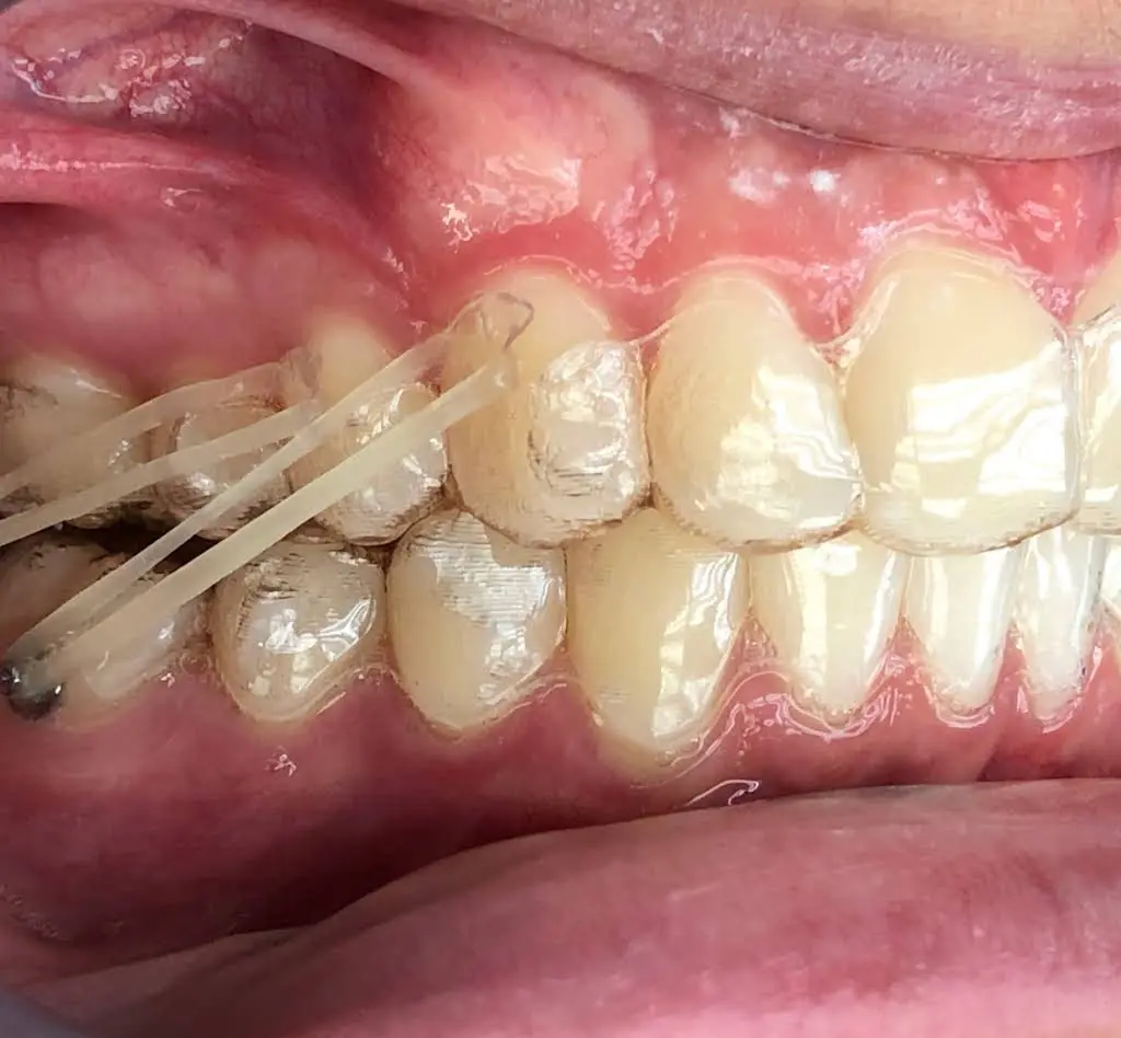 Henn Orthodontics