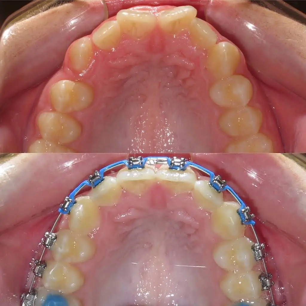 Henn Orthodontics