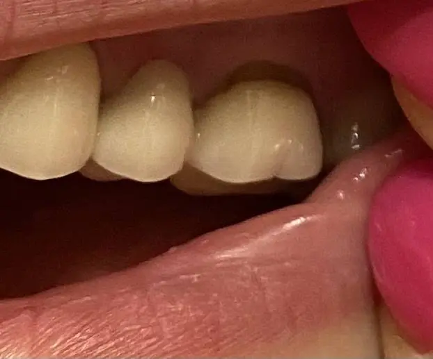 Mortenson Family Dental