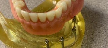 Akron Dental Concepts LLC