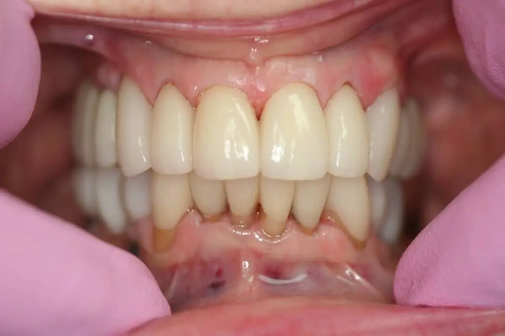 McCune Dental