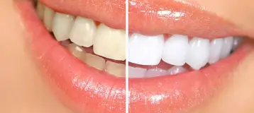 Fairlawn Plaza Dental Arts