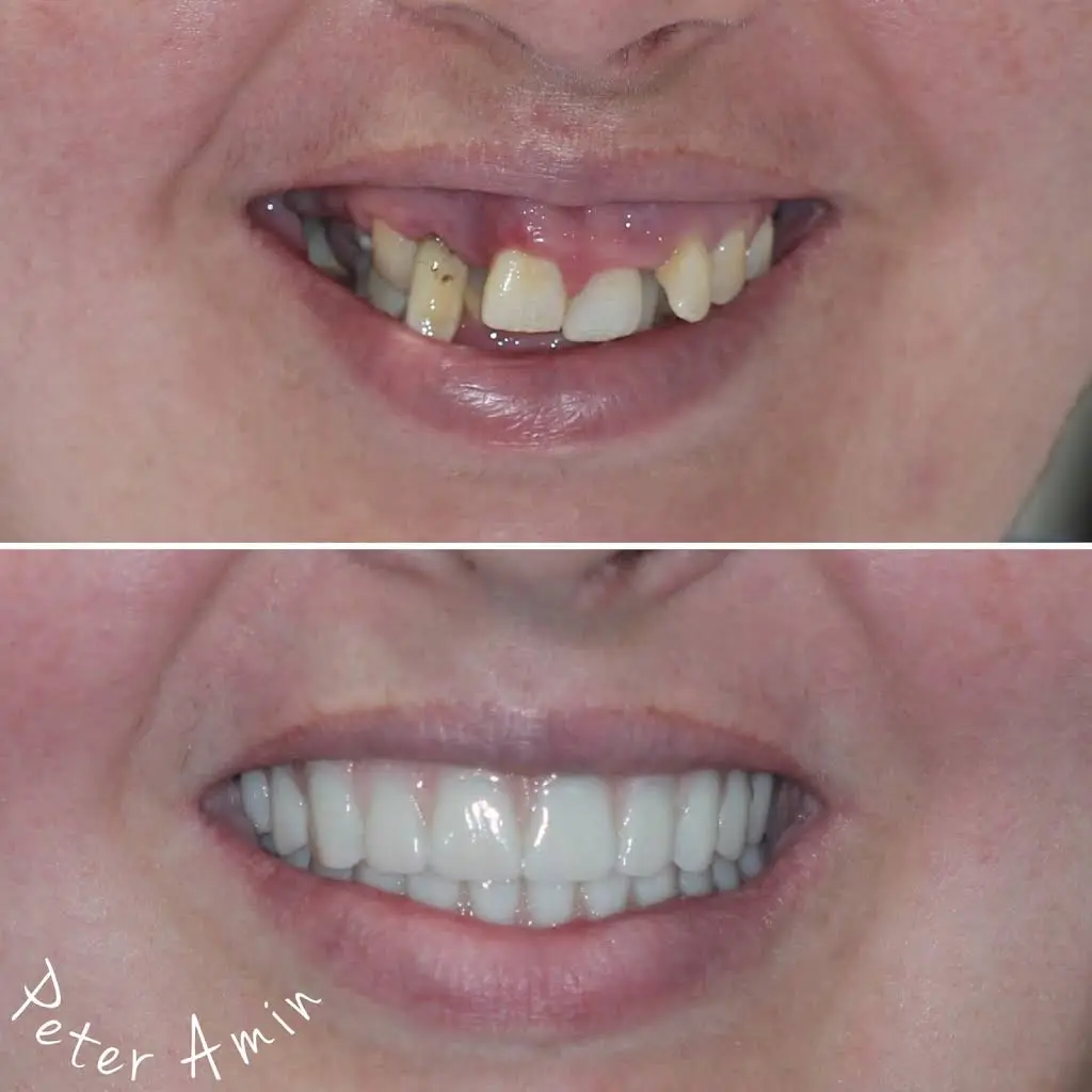 Cleveland Dental Implant Center