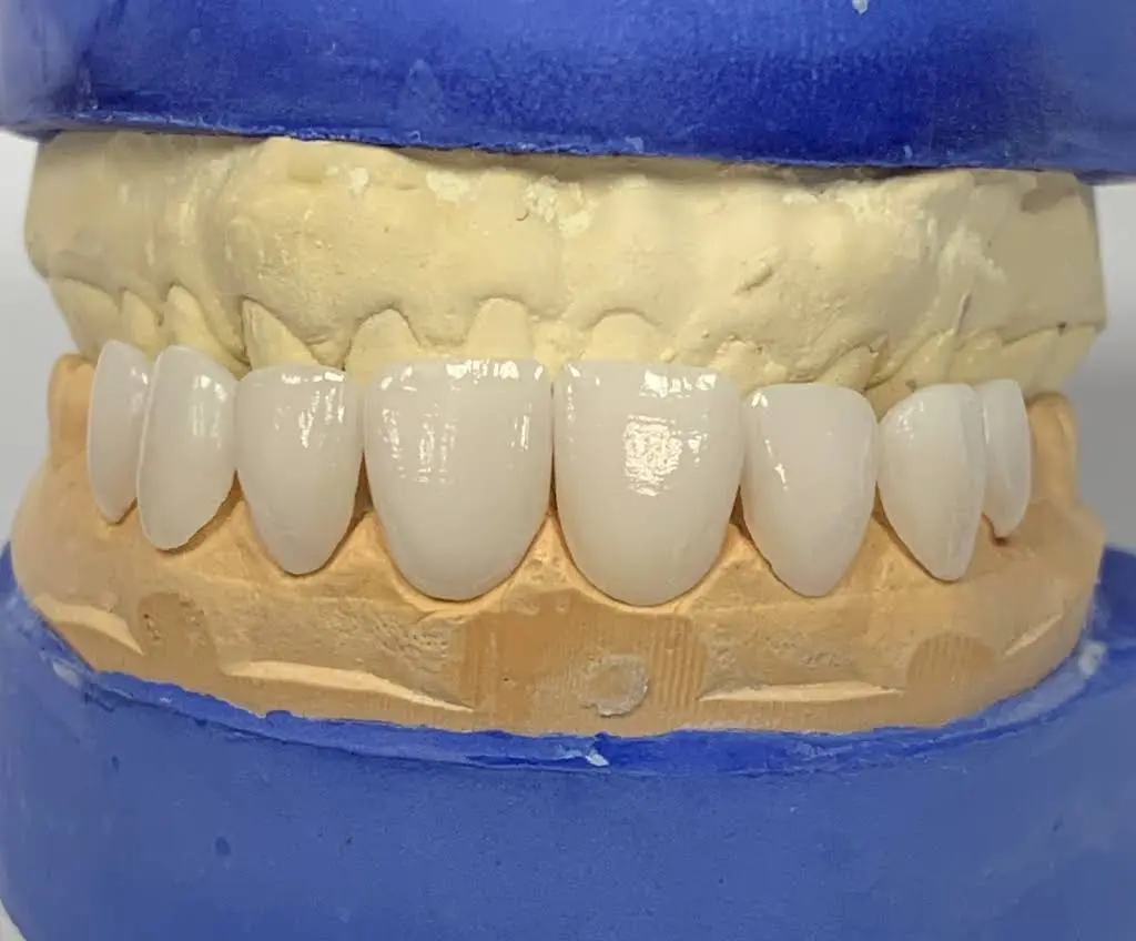 Dental Implants Cleveland / Rocky River Dental