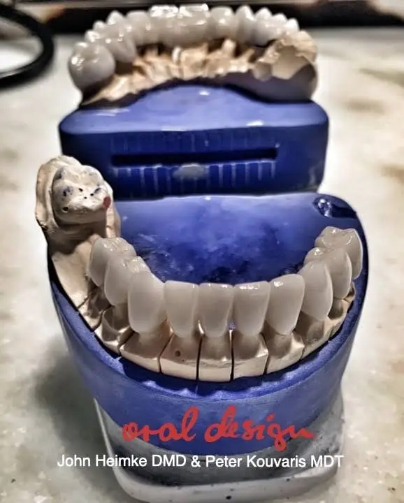 Dental Implants Cleveland / Rocky River Dental