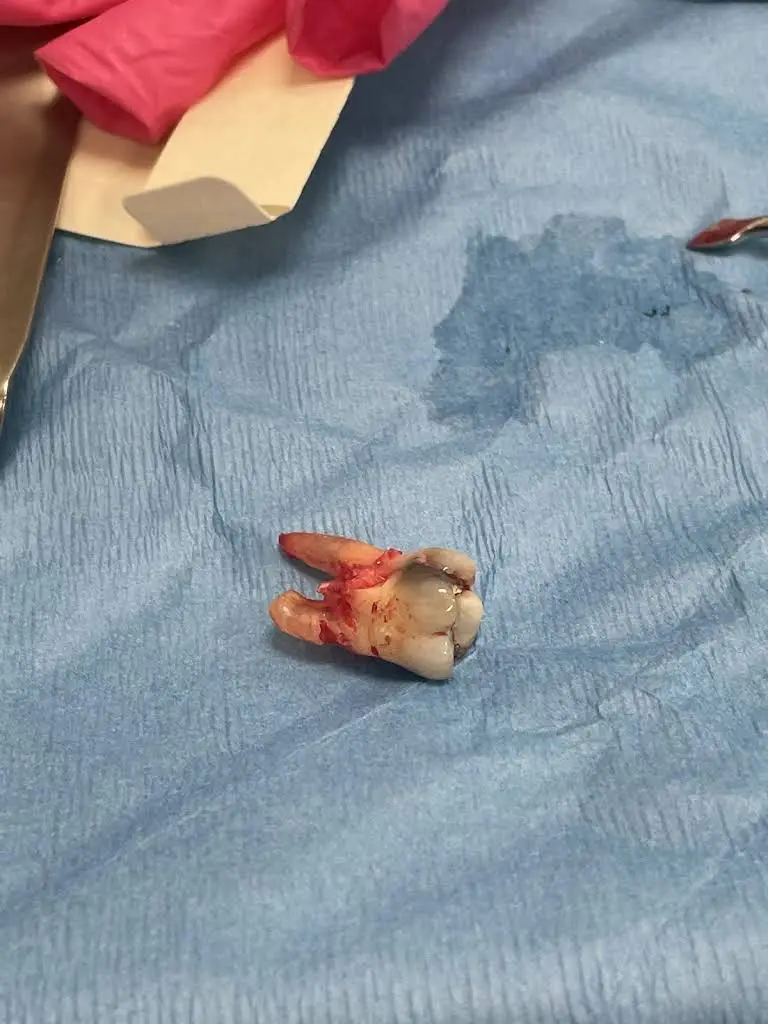 Ohio Dental Implants & Oral Surgery