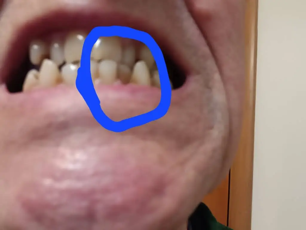 Ohio Dental Implants & Oral Surgery