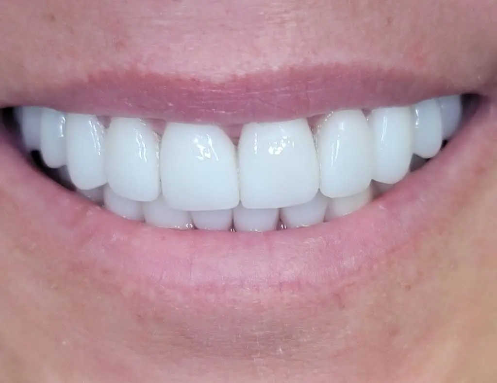CLE Smiles by Dr. Niki: Nicole Cochran, DDS