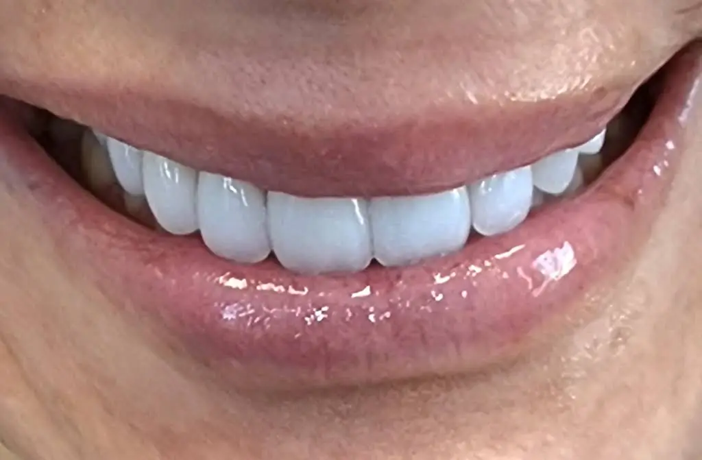 CLE Smiles by Dr. Niki: Nicole Cochran, DDS