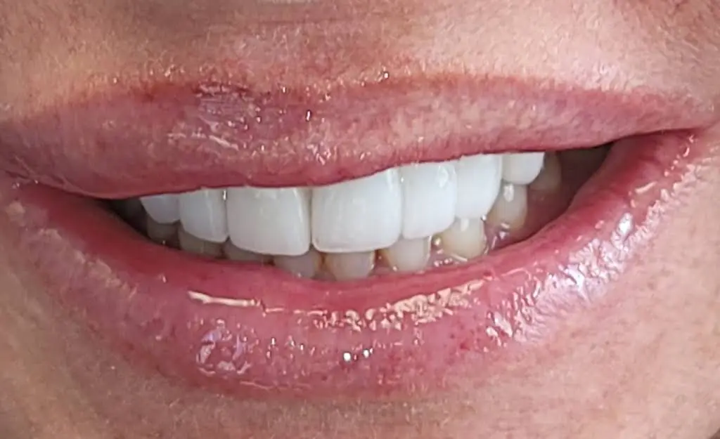 CLE Smiles by Dr. Niki: Nicole Cochran, DDS