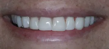 Lakewood Dental Associates
