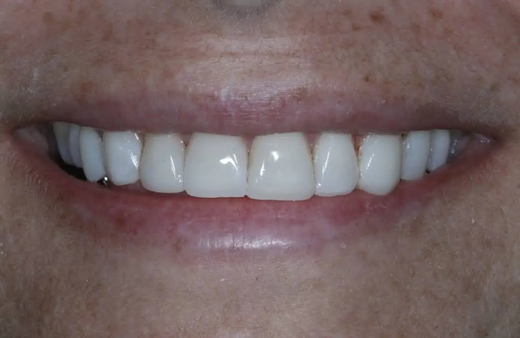 Lakewood Dental Associates