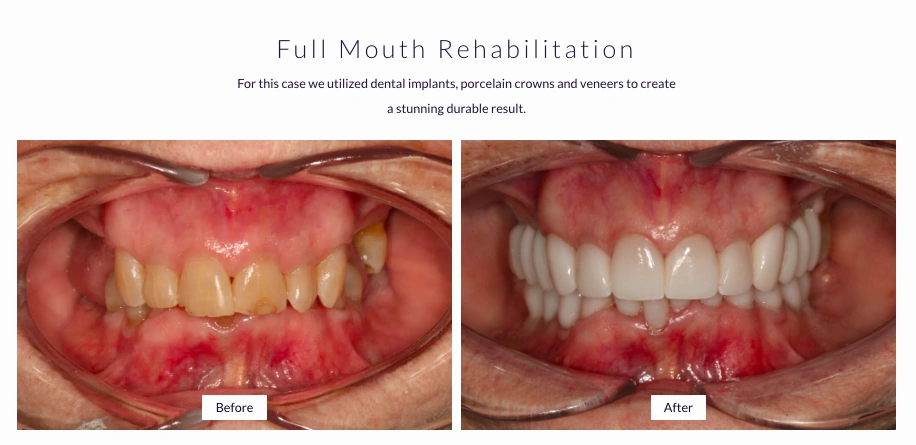 Lakewood Dental Associates